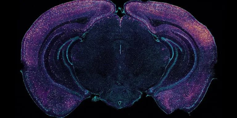  jellyfish electric ray crampfish numbfish torpedo head cabbage flatworm platyhelminth-0