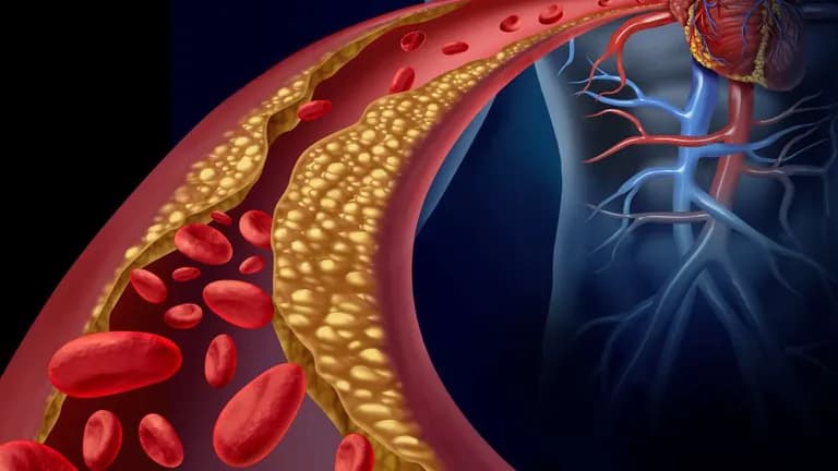  nematode nematode worm roundworm banana pomegranate hotdog hot dog red hot-0